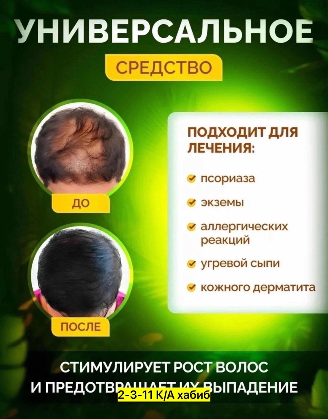 alhaag масло черного тмина 500 мл,экстракт женьшеня,масло черного тмина эфиопское 100 мл,масло черного тмина baraka,костус кыст аль хинди