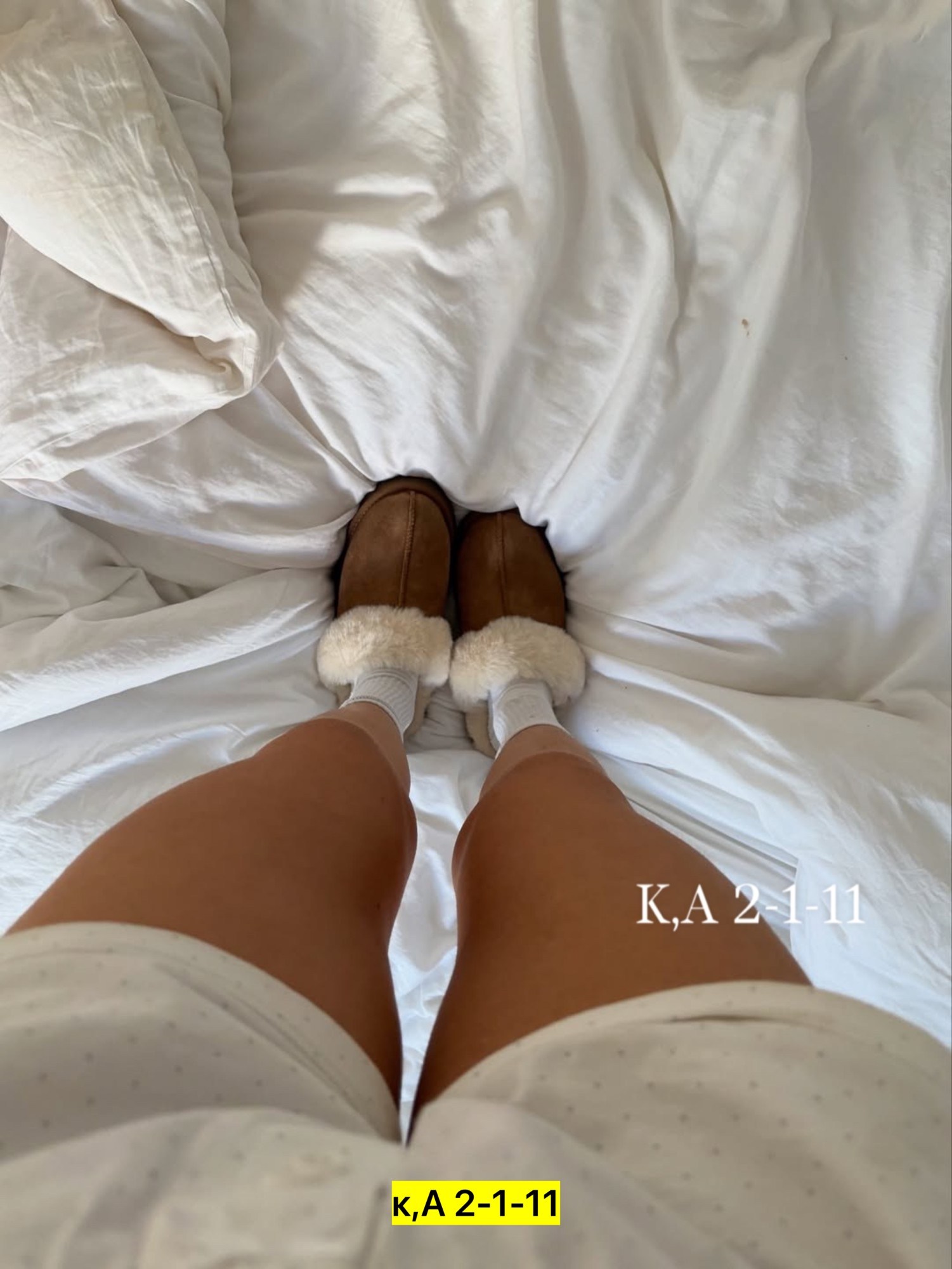 ugg slipper,тапочки домашние женские меховые,женские тапочки с мехом,тапочки домашние меховые,тапочки домашние