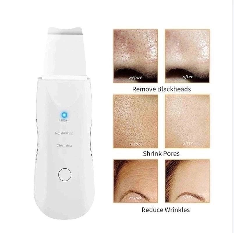 аппарат для ультразвуковой чистка лица,аппарат для ультразвуковой чистки лица массажер,аппарат для ультразвуковой чистки лица аппарат,gezatone аппарат для ультразвуковой чистки лица,ультразвуковой апп