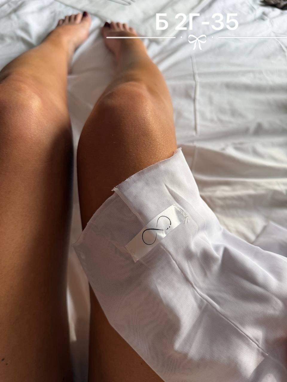 носки стиль,ноги,операция на ноге,операции,отвратительные ноги